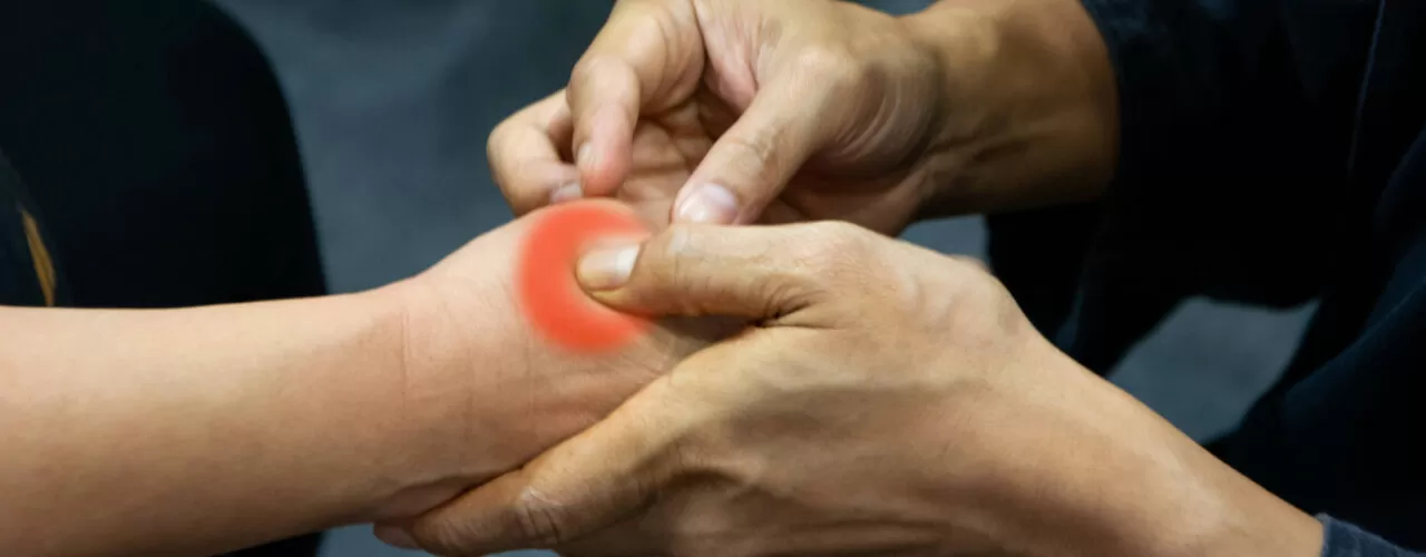 Dry needling therapy in Edmonton